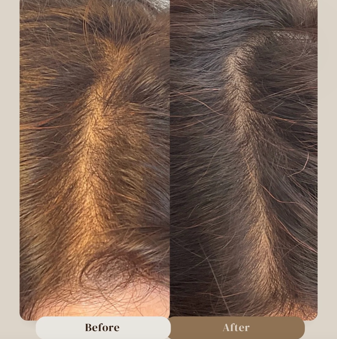 Minoxidil 5% Hair Growth Drops for Women (Made in USA)