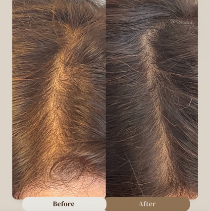 Minoxidil 5% Hair Growth Drops for Women (Made in USA)