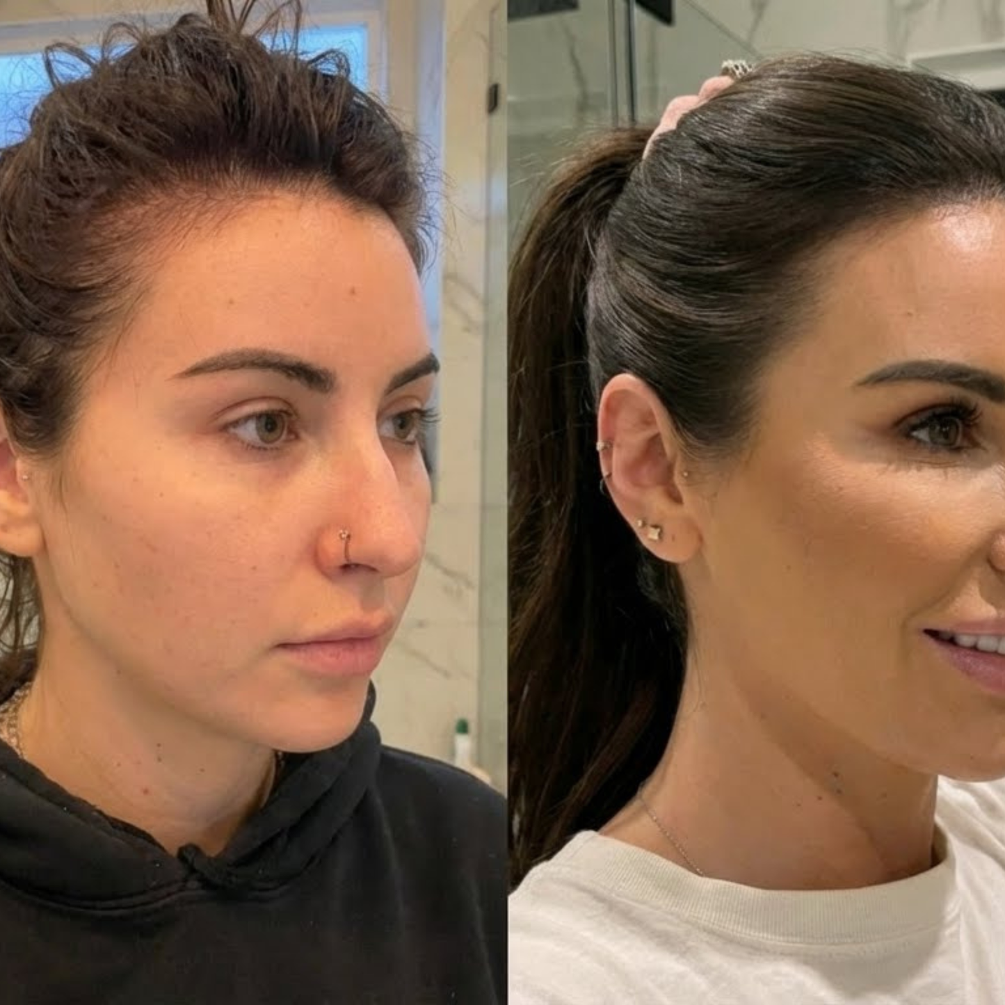 Minoxidil 5% Hair Growth Spray for Women